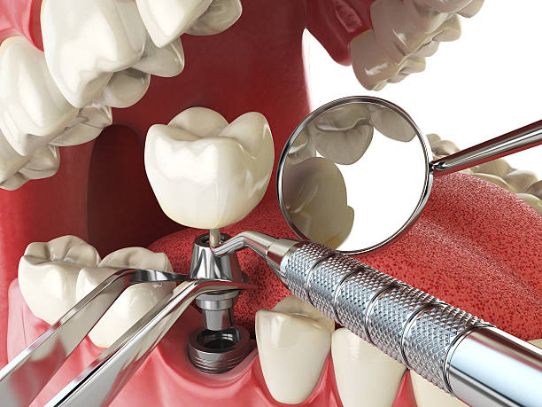Best Broken or Cracked Tooth Emergency Dentist in West End, NY