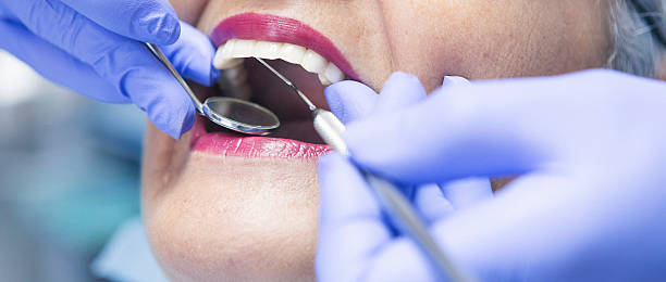 Best Emergency Dentist for Lost Fillings or Crowns in West End, NY